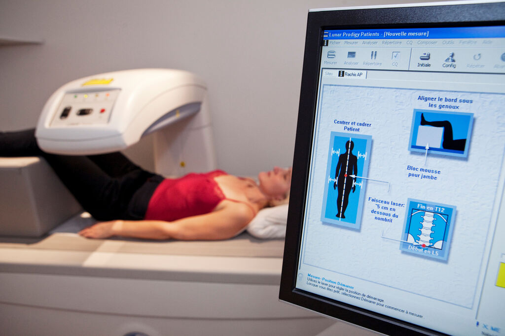 Paciente realizando exame de densitometria óssea para diagnóstico precoce de sintomas de perda de massa óssea e prevenção da osteoporose.