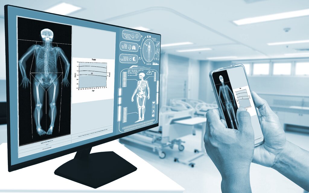 valor da massa óssea