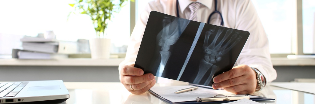 osteoporose pode virar cancer - Osteoporose pode virar câncer? Entenda de uma vez por todas qual a relação